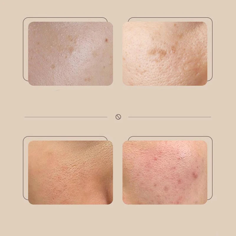 Rice Isolation Cream