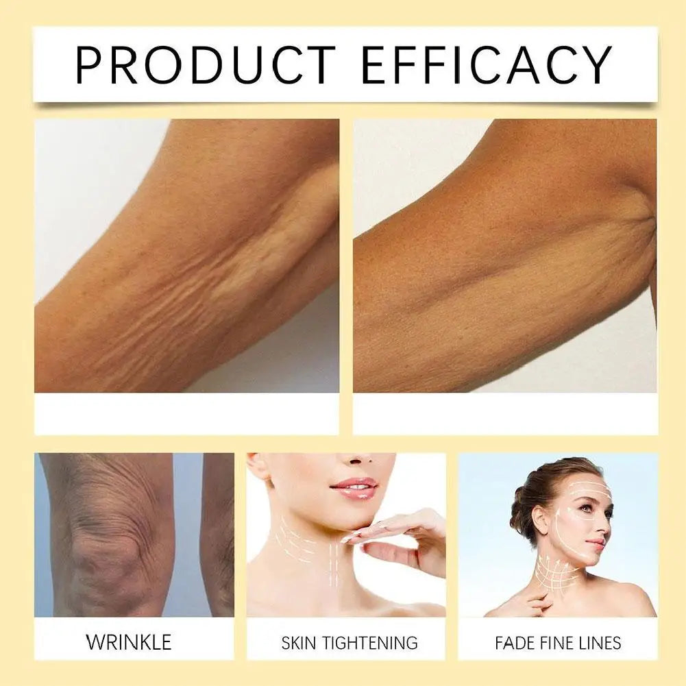 Retinol