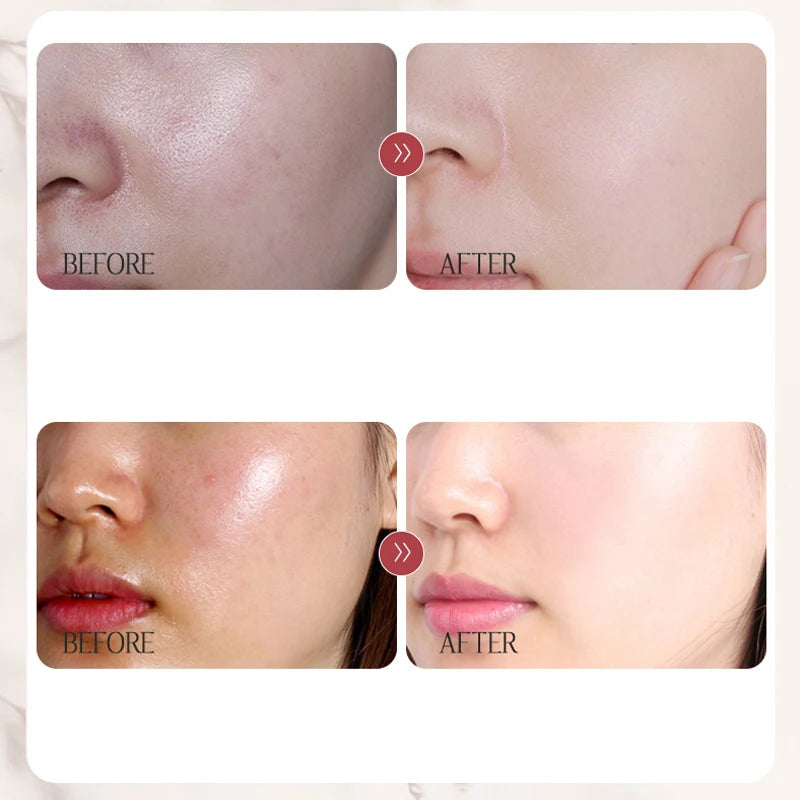Rice Isolation Cream