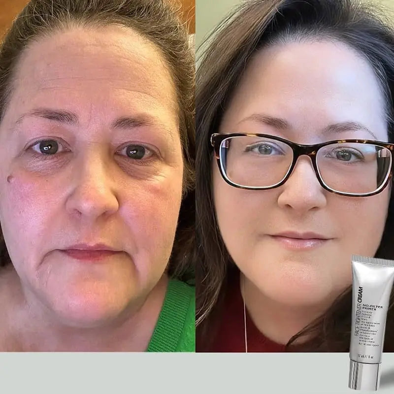 Face Tightener
